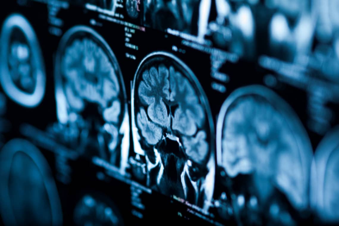 what does meth do to the brain