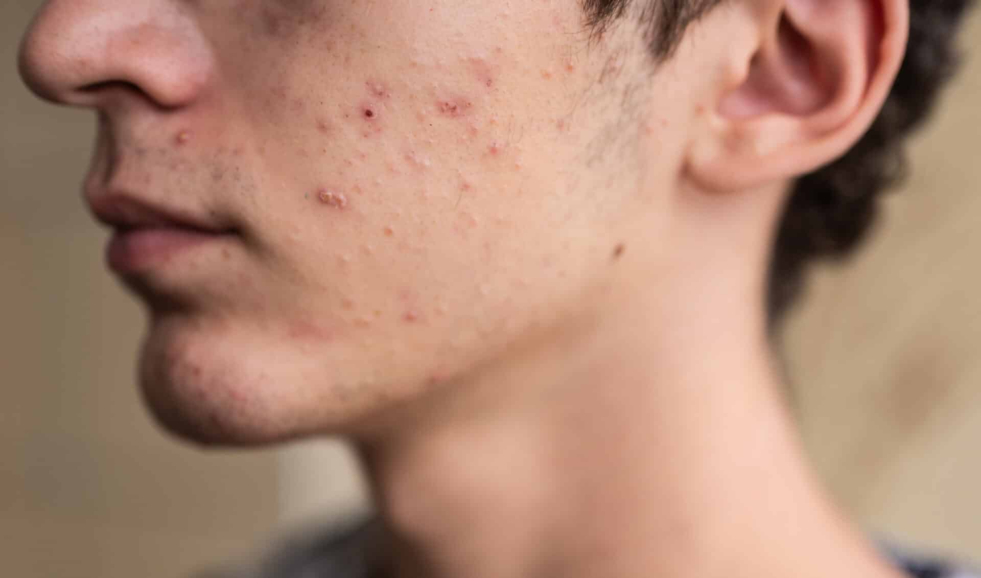 skin problems from alcohol