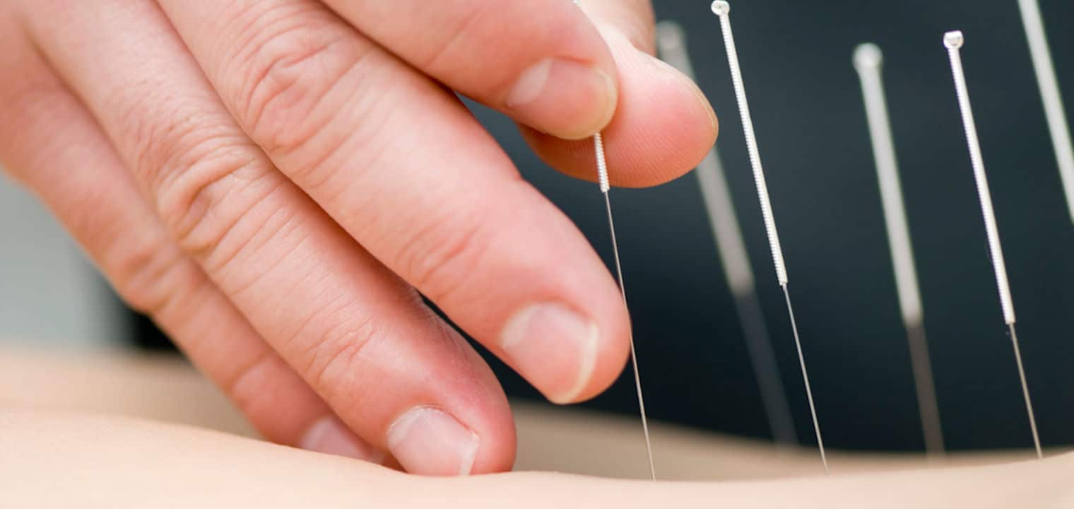 acupuncture for addiction